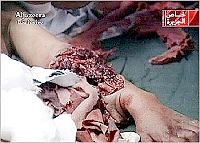 Opfer des mrderischen Raubberfalls